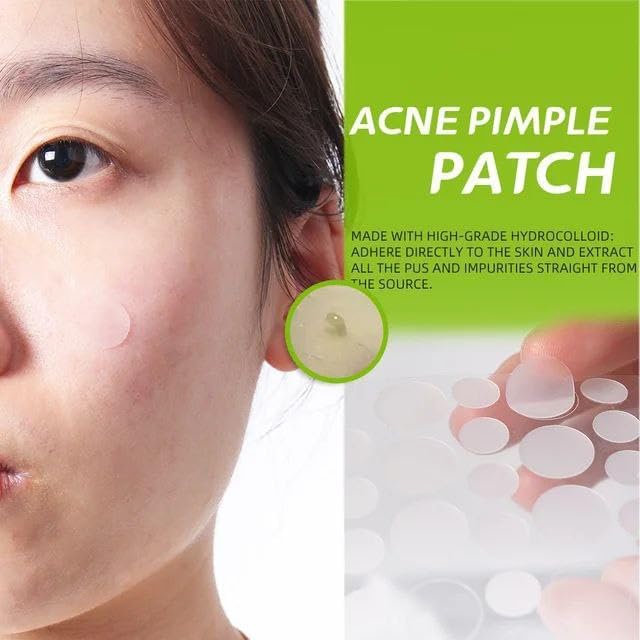 BlushMint Acne Pimple Patch (72 Pieces)