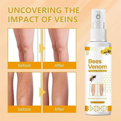 BlushMint Bee Venom Spider Veins Spray Pack of 2