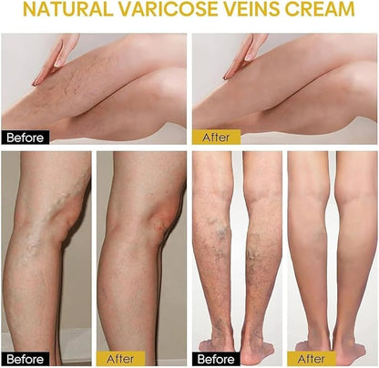 BlushMint Bee Venom Spider Veins Spray Pack of 2