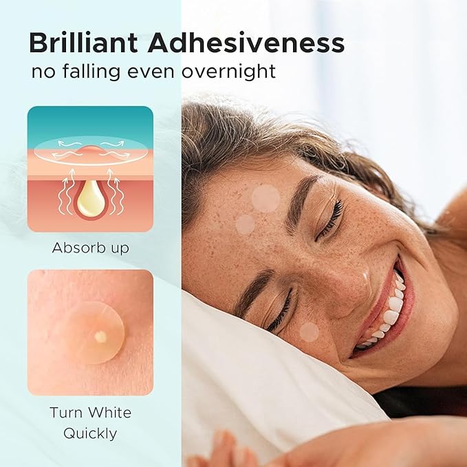 BlushMint Acne Pimple Patch (72 Pieces)